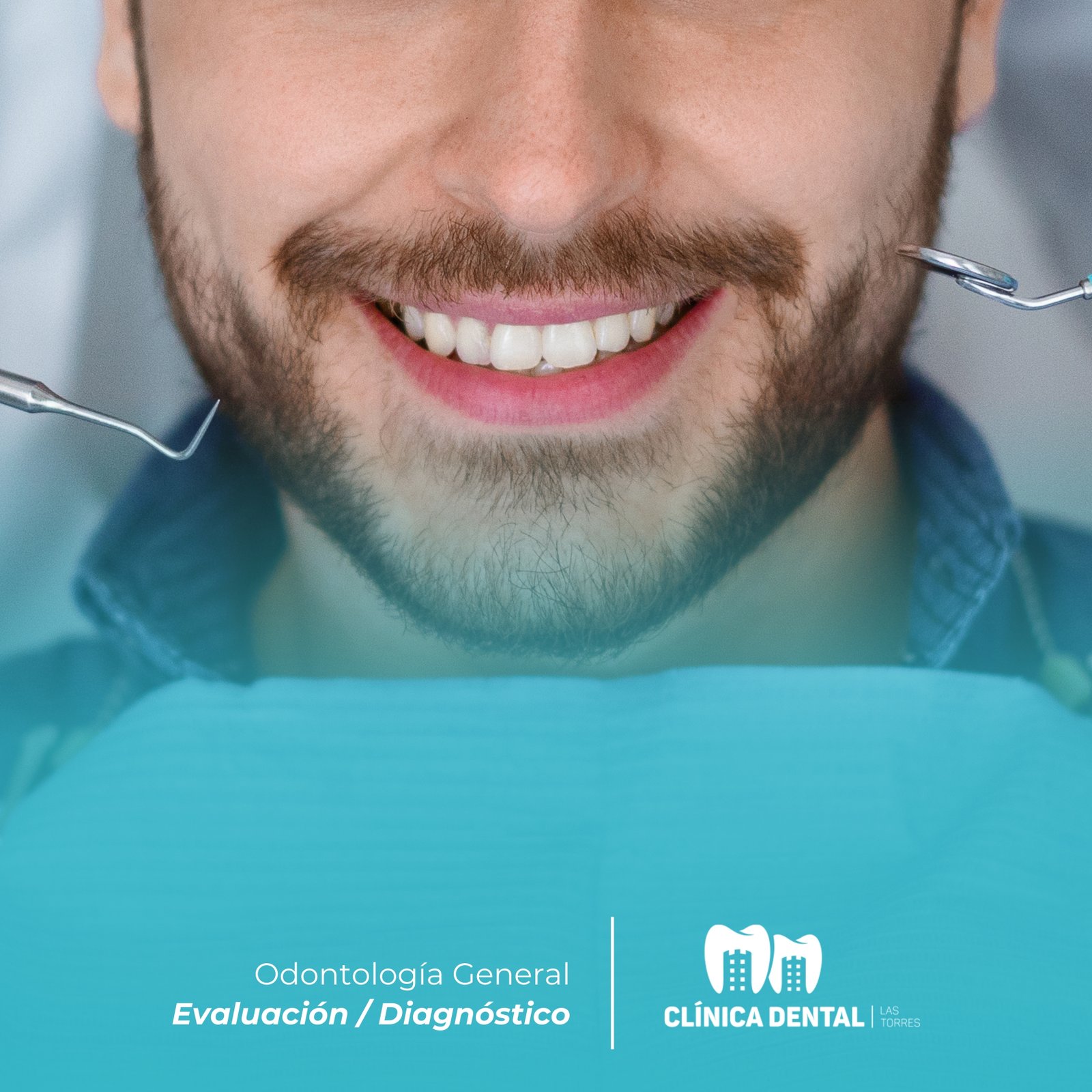 blanqueamiento led profesional puente alto